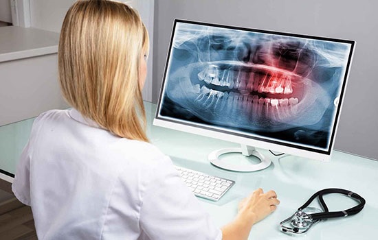Панорамный снимок зубов — что это такое и когда его нужно делать?