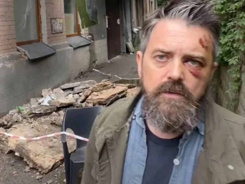 В Киеве на американского режиссера, который приехал документировать войну, упал балкон | ВИДЕО