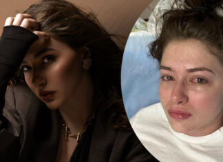 Ее не узнать: где сейчас Екатерина Тышкевич, которая была в коме и боролась с тяжелой болезнью