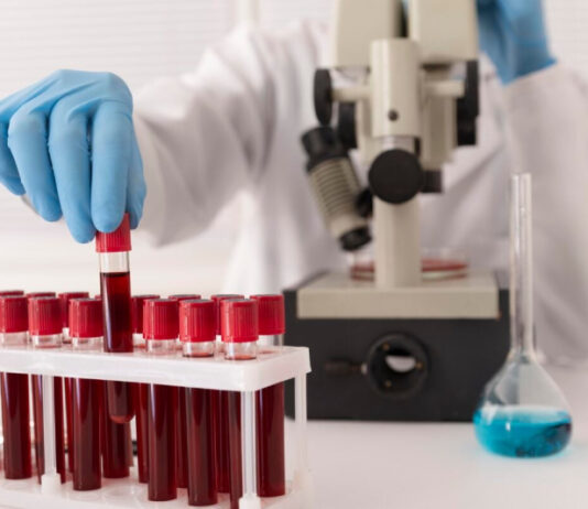 Ученые разработали анализ крови, который выявляет 50 видов рака на ранних стадиях