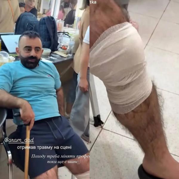 Чувствую невыносимую боль, &ndash; звезда "Безумной свадьбы" получил серьезную травму на сцене
